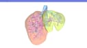 segment medical data and create accurate medical 3d models