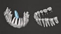 do dental cbct dicom segmentation and stl conversion