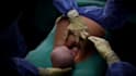 3d medical animation, surgery animation and medical explainer videos