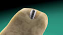 create 3d dental implant, surgery explainer and tooth treatment animation video