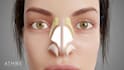 create realistic 3d medical animation, surgical procedure, anatomy visualization