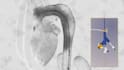 create scientifically accurate 3d medical animation