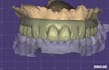 create professional dental cad designs in exocad