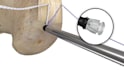 create 3d medical device animation, surgical procedure and orthopedic animation