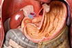 create 3d medical, anatomy, surgery and device animations