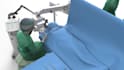 create 3d otosclerosis stapedotomy and ear surgery animation