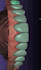design wax up mock up and veneers using exocad