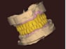 do professional dental cad cam design using exocad