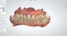 design anatomical crown and bridges using 3shape dental system