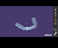 provide expert exocad dental cad design services