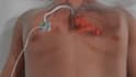 create 3d cardiovascular medical device animation and medical explainer video