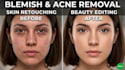 expertly remove objects, pimples, and tattoos from photos