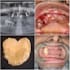 plan and design surgical guide