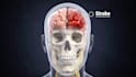 create 3d medical surgery animation brain anatomy neurological disease explainer