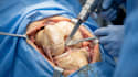 create 3d medical animation for surgical procedure or anatomy