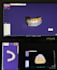 design dental crowns,bridges and implants as exocad expert