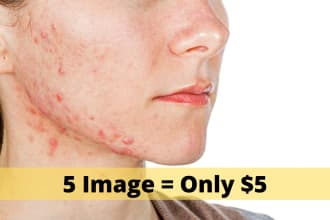 retouch your skin, remove pimples in face