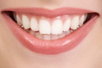 answer a dental question