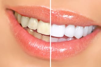 whiten teeth in photoshop