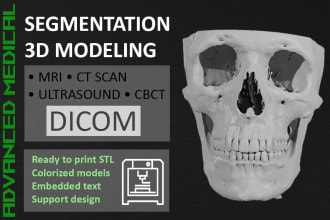 create a 3d model from your ct or mri dicoms