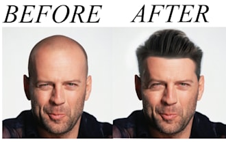 make hair on the bald head