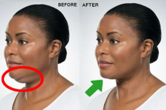 double chin removing, teeth whitening, photo enhancement