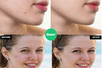 retouch image, remove acne, pimples, wrinkles, and blemishes