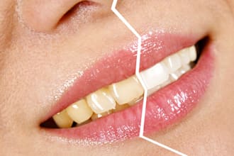 whiten your teeth in 3 pictures
