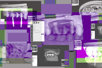 design all types of dental bridges on natural teeth