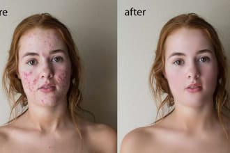 improve your image quality and look