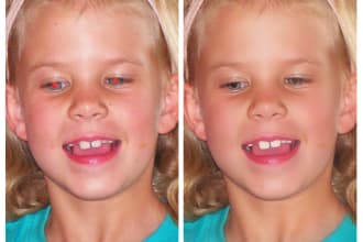 do red eye removal and skin retouching