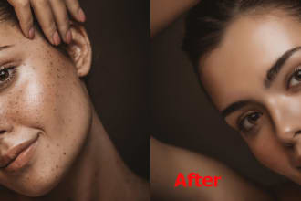 do model, fashion image, skin retouching and dark spot clean