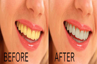 white your teeth and remove stains quickly