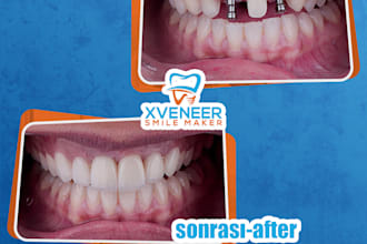 do a dental clinic social media story and post templates