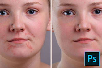 photoshop away any imperfections in your selfie