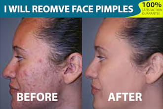 do remove your face pimples in 24 hrs