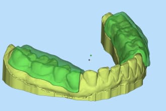 design dental appliances for you using exocad and 3shape software