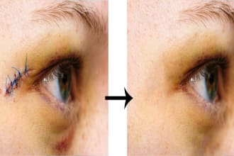 do skin retouching, remove blemishes, acne in pictures