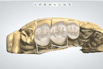design dental crowns,bridges,veneers in 3shape