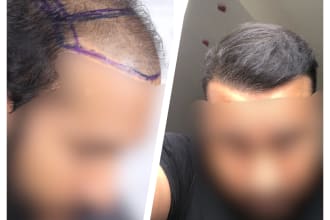 hair loss solutions analysis report