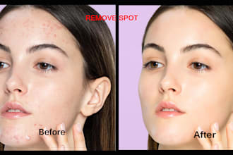 remove spot, blemishes, wrinkles, unwanted spot