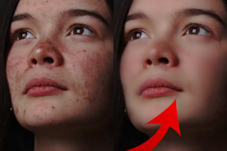 remove blemishes from your photo