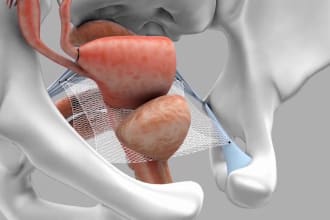 do 3d medical animation surgery 3d medical video