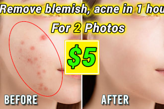remove blemish, acne, pimple, freckle, wrinkles,skin retouch