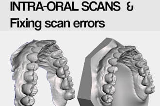 add a base and fix your intraoral scans