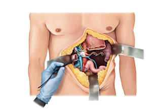 create surgical and anatomical art for medical professionals
