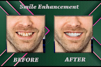edit your teeth using photoshop fast delivery