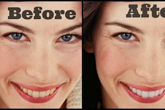 turn your smile into a perfect white smile