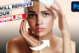remove your 15 image pimples and brightens it within 1 day