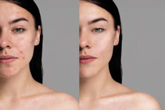 retouch the skin on your pictures